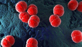 Bé 4 tháng tuổi phải cắt chi do nhiễm não mô cầu, bệnh đang vào mùa phụ huynh cần chú ý