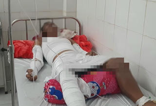 Nổ lớn trên ghe biển, 3 người bị thương nặng