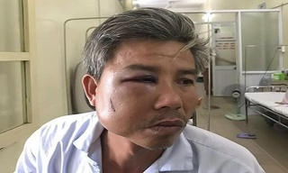 Khởi tố chủ quán cà phê đánh nhân viên Trung tâm Công viên cây xanh Huế