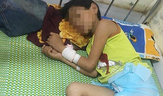 Bé trai 11 tuổi nhập viện vì bạn thách uống hơn 1 lít rượu