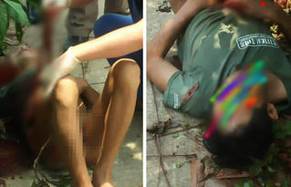 Người đàn ông tự cầm dao đâm thủng bụng mình giữa trưa nắng