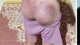 Công an viên đánh thâm tím mông bé gái 12 tuổi 