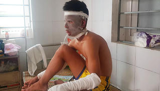 Cầu thủ giơ bóng bay che nắng, 4 người phải cấp cứu