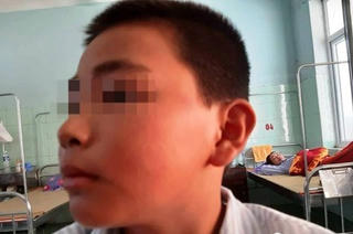 Giám đốc Sở GD-ĐT Quảng Bình đau lòng về việc nam sinh bị tát 231 cái 