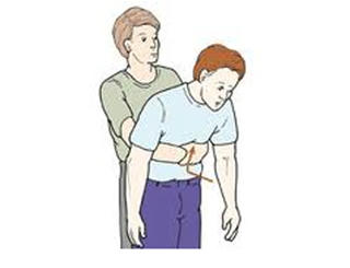 Xử trí khi trẻ hóc dị vật ngày Tết