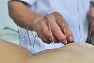 Kinh nghiệm phục hồi di chứng tai biến bằng châm cứu