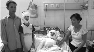 Thích mực nướng cồn, cả nhà nhập viện
