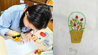 Bệnh viện Đại học Y Hà Nội chuyển 2 ngón chân tạo hình 2 ngón tay cho nữ bệnh nhân