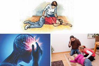 Nhận diện sớm và điều trị hiệu quả bệnh nhân đột quỵ 