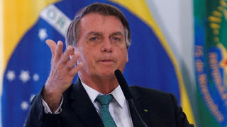 Tổng thống Brazil nhập viện, có thể phải phẫu thuật