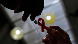 Người phụ nữ đầu tiên được chữa khỏi HIV 