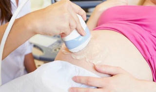 Thực hư dung dịch chọn thai nhi