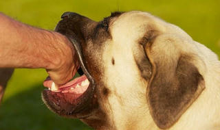 Bé trai tử vong thương tâm sau 2 tháng bị chó dại cắn 