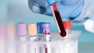 Trình tự thông báo kết quả xét nghiệm HIV dương tính