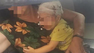 Bé trai 16 tháng tuổi  bị chổi lau nhà rơi trúng đầu 