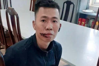 Đưa đối tượng chém mẹ tử vong ở Mê Linh đi giám định tâm thần