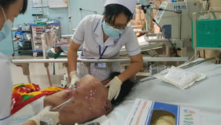 Nữ nhân viên không kích dục cho khách bị chủ quán cà phê tra tấn như thời trung cổ