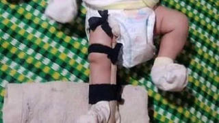 Sự thật bất ngờ vụ người cha bị tố đánh gãy chân con