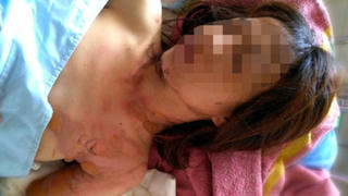 Bất ngờ thủ phạm tạt xăng cô gái ở Lâm Đồng