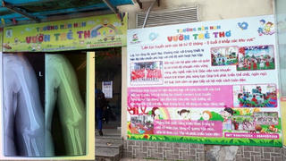 Đại diện trường mầm non 'lên tiếng' vụ bé gái 5 tuổi ngã gãy tay