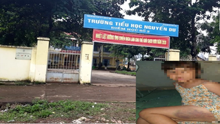 Xem xét trách nhiệm hiệu trưởng vụ bé gái bị giáo viên đánh tím đùi