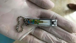 Học theo video trên Youtube, bé 9 tuổi nuốt bấm móng tay vào bụng