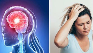 Khoảng 200.000 người Việt Nam mắc bệnh đột quỵ mỗi năm