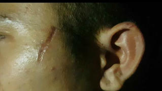 Chuyện đau lòng từ vết sẹo chi chít trên người cậu bé làm thuê