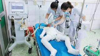 Nghi án bố tẩm xăng thiêu 3 con nhỏ rồi tự tử