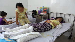 Chồng đổ dầu đốt nệm vợ con đang ngủ khiến 3 người bị bỏng