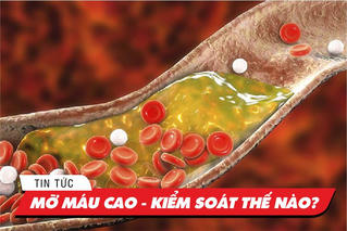 5 cách hỗ trợ điều trị mỡ máu cao tại nhà không cần dùng thuốc