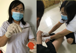 Thích ăn tiết canh, người đàn ông bị giun rồng kí sinh trong đùi 