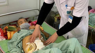 Nhiễm độc toàn thân, thủng ruột non do ăn... gà