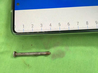 Người đàn ông tự cầm cây đinh dài 4cm đóng vào đầu