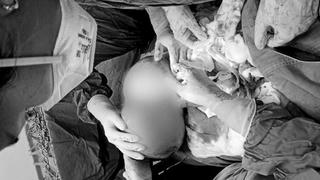 Người phụ nữ sống chung với khối u nặng 5,5kg