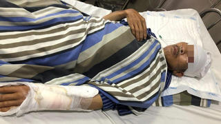 2 người đàn ông chém nhau nguy kịch 