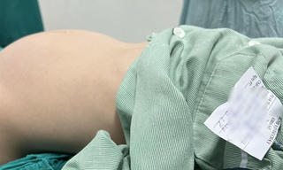 Bé gái 12 tuổi mang khối u buồng trứng 'khổng lồ'