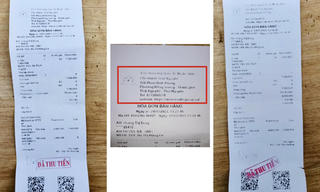 Người phụ nữ mất vì thiếu hiểu biết về bệnh Lupus ban đỏ