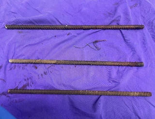 Cứu nam thanh niên bị 3 cọc sắt đâm xuyên qua người