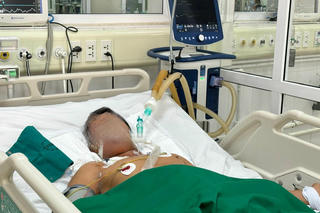 Nguy kịch phải thở máy sau khi cắt trĩ tại nhà