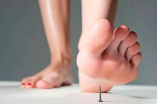 Hà Nội có 2 ca tử vong do uốn ván