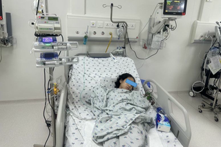 Bé gái 12 tuổi bị vỡ nang phổi