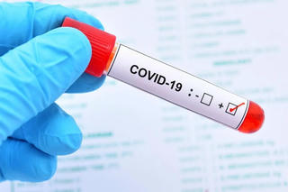 Phát hiện biến thể phụ COVID-19 đáng lưu tâm tại TP HCM