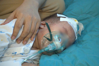 Trẻ mắc sởi khi chưa đủ tuổi tiêm chủng, Bộ Y tế nêu giải pháp