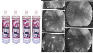 'Uống nhầm' nước tẩy rửa bồn cầu, thiếu nữ phải cấp cứu