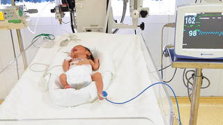 Cứu bé trai sinh non bị suy hô hấp nặng trong khu cách ly 