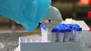 TP HCM chính thức công khai chi phí xét nghiệm COVID-19