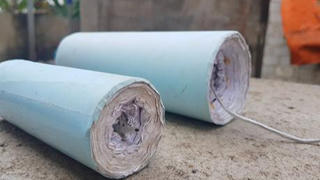 Bé trai 9 tuổi "nát mặt" do pháo tự chế