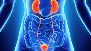 6 điều cần làm để phòng tránh ung thư bàng quang 