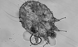 Liên tục tiếp nhận các trường hợp bị ghẻ sinh dục